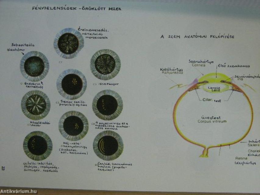 Irisz diagnosztika