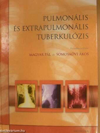 Pulmonális és extrapulmonális tuberkulózis