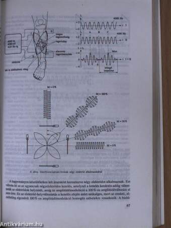 Fizioterápia