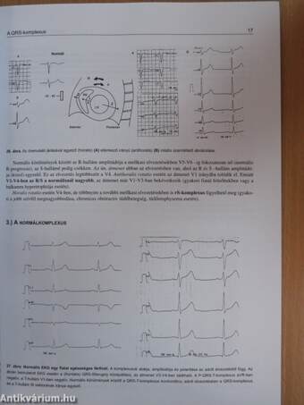 Klinikai EKG alapismeretek