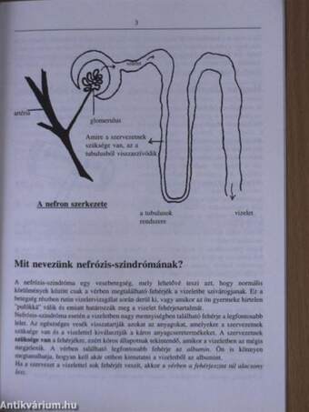 Amit a nefrózis-szindrómáról tudni kell