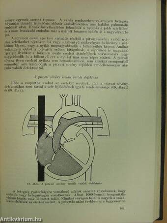 A szív és a nagyerek veleszületett fejlődési rendellenességei