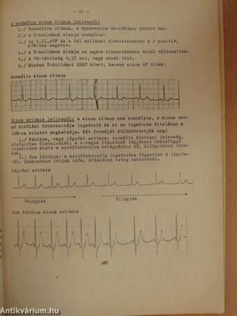 EKG alapismeretek