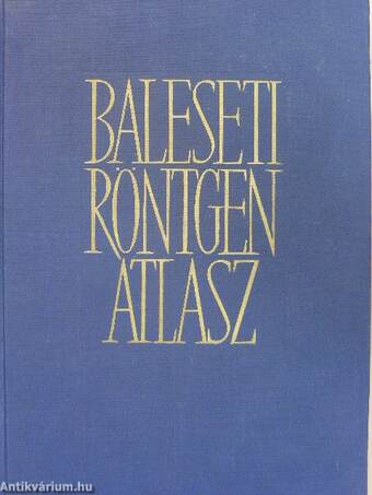 Baleseti röntgenatlasz