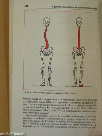 Gerincbetegségekről