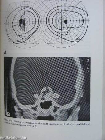 Consultation in Ophthalmology