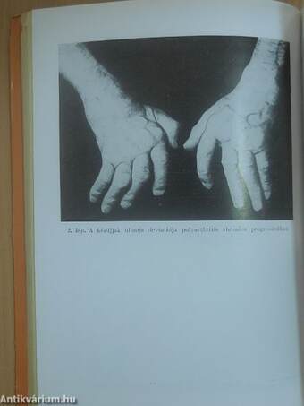 A gyakorló orvos rheumatologiája