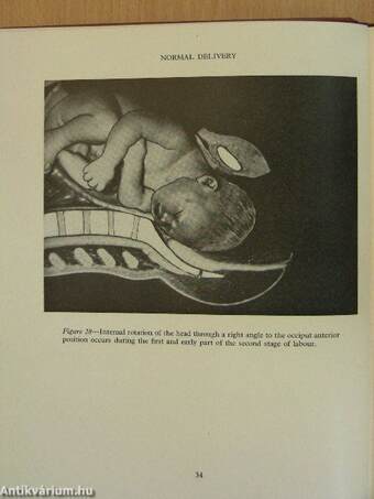 Illustrated obstetrics