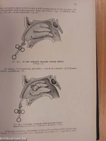 Orr-, torok-, gégegyógyászat