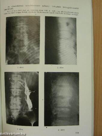 Magyar Traumatológia, Orthopaedia és Helyreállító Sebészet 1962/4.