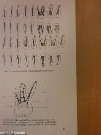 Endodoncia