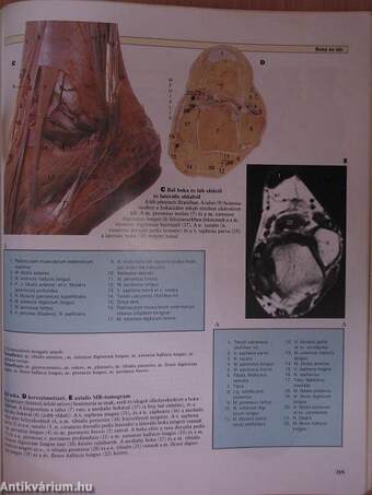 A humán anatómia színes atlasza