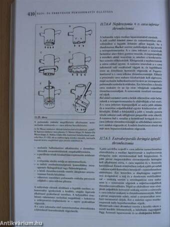 Szív- és érbetegségek perioperatív ellátása