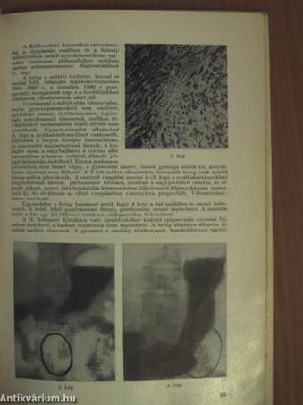 Magyar Radiologia 1965. április