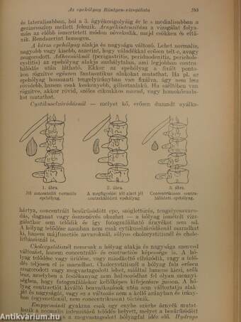 Orvosképzés 1926./A tüdőtuberculosis sebészeti kezelése/Dolgozatok a Budapesti Királyi Magyar Pázmány Péter Tudományegyetem II. és I. számú sebészeti klinikájáról