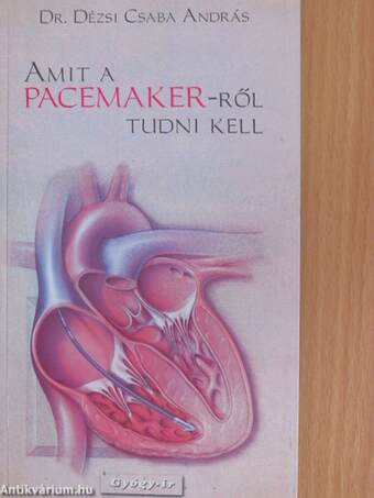 Amit a Pacemaker-ről tudni kell