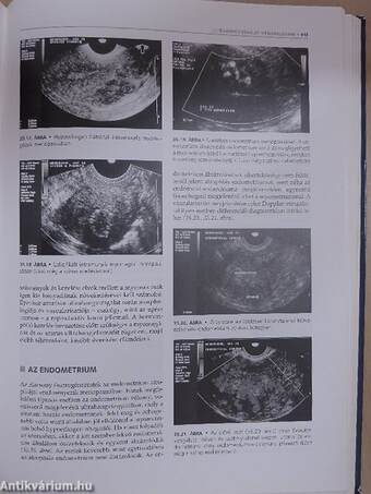 Szülészet-nőgyógyászati ultrahang-diagnosztika