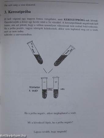 Új veséről mesélve gyermekeknek