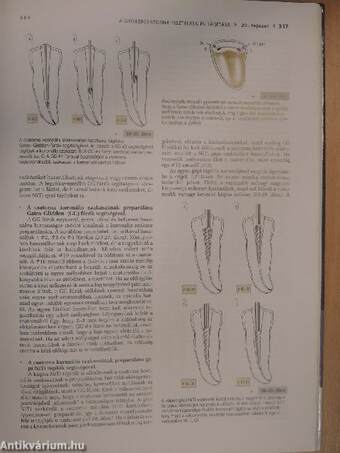 Megtartó fogászat és endodoncia