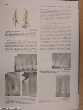 Megtartó fogászat és endodoncia