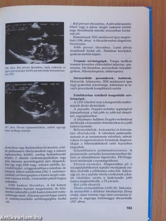 Belgyógyászati ultrahang-diagnosztika