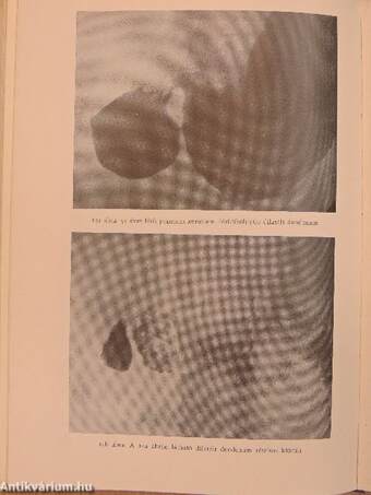 A leggyakoribb diagnosztikus tévedések