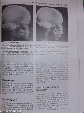 Stafne's Oral Radiographic Diagnosis