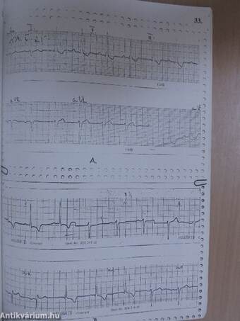 Munkafüzet az elektrokardiográfiai gyakorlatokhoz