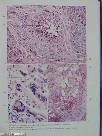 Mikroszkópos patológia medikusoknak