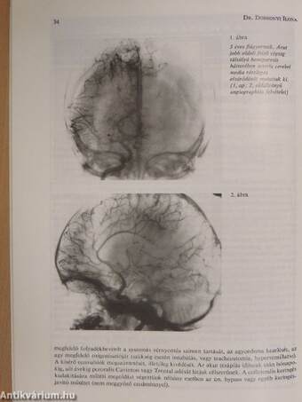 Cardiologia Hungarica 1989/1