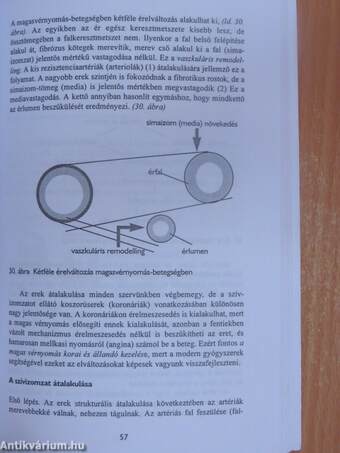 Magas vérnyomás a betegek szemszögéből