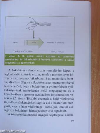 A fekélybetegség és a Helicobacter pylori-fertőzöttség