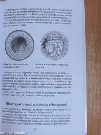 Érbetegségekről mindenkinek