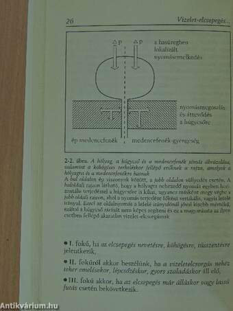 Női vizelettartási problémák