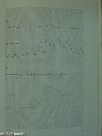 Cardiomyopathia