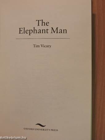 The Elephant Man