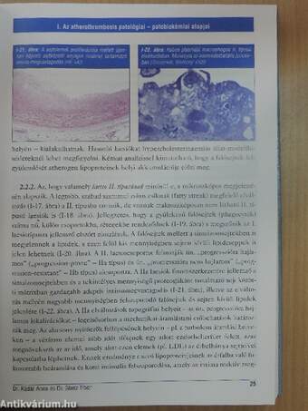 Az atherothrombosis