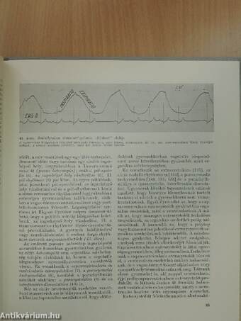 Hallgatódzás a szív felett II. (töredék) - 3 db hanglemezzel