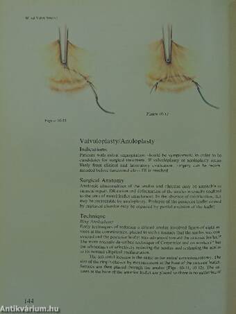 Manual of Cardiac Surgery I. (töredék)