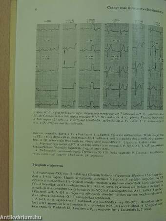 Klinikai adatok a Lidoflazine (Clinium) hatásmechanizmusához