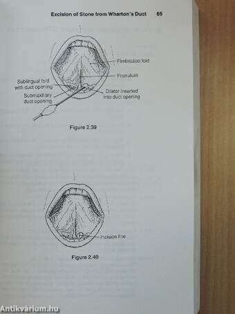 Surgical Anatomy and Technique