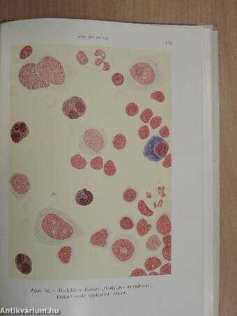 Atlas of Haematology