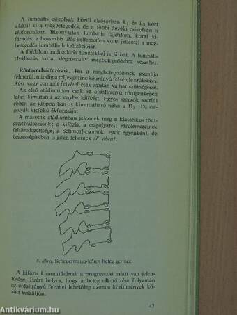 A gerincbetegségek differenciáldiagnosztikája az ortopédiában