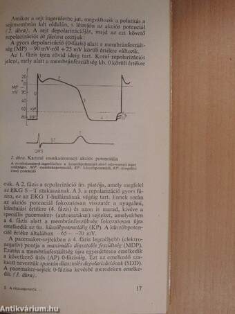 A ritmuszavarok diagnózisa és terápiája