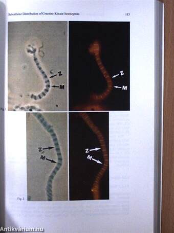 Creatine Kinase Isoenzymes