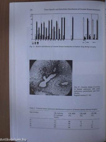 Creatine Kinase Isoenzymes