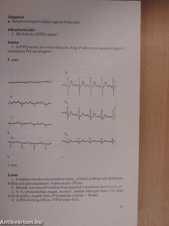 EKG atlasz