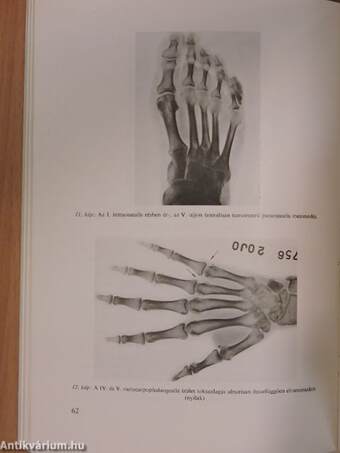 Magyar Radiologia 1978/1.