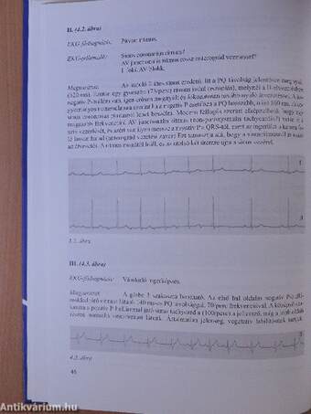 EKG enciklopédia