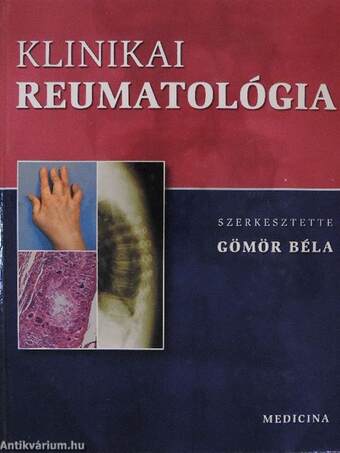 Klinikai reumatológia